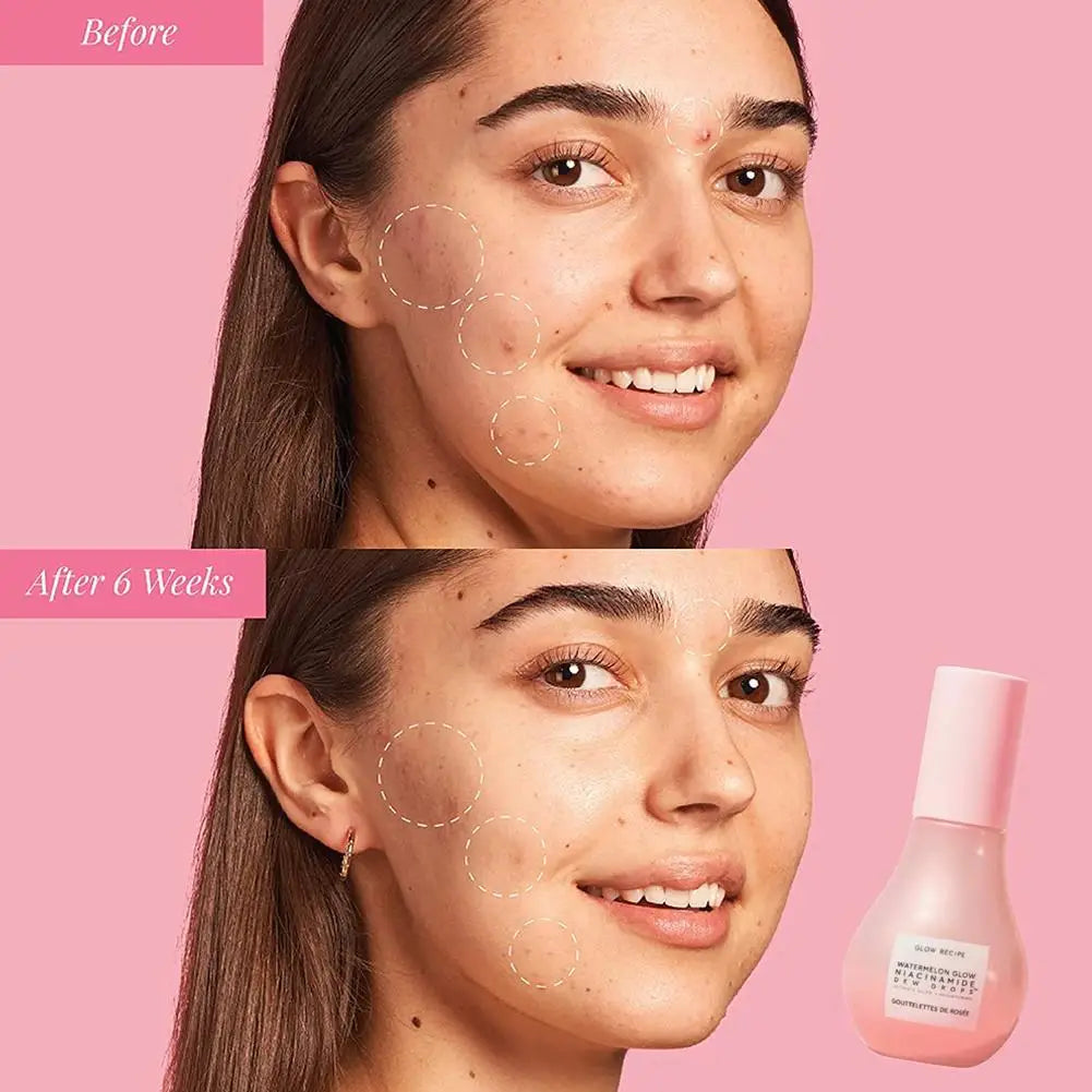 Niacinamide Serum Watermelon